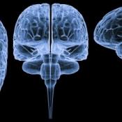 Three views of the brain