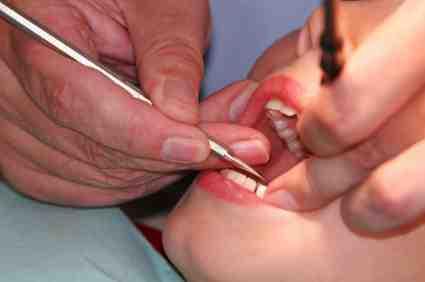 Dental Visit