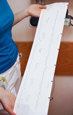 Nurse looking at contraction monitor graph