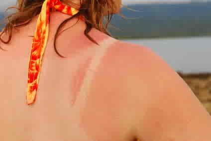 Rash In Adults