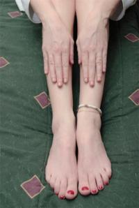 medical causes of leg cramps