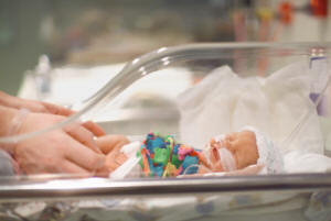 Premature babies
