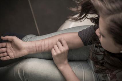 Self harming teenager