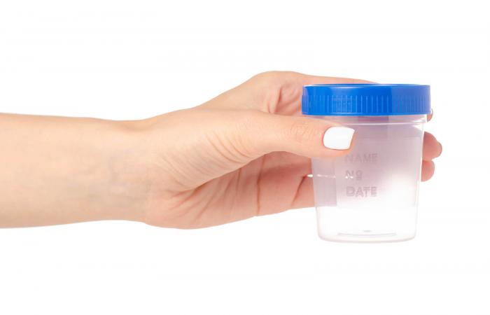Urine Drug Tests
