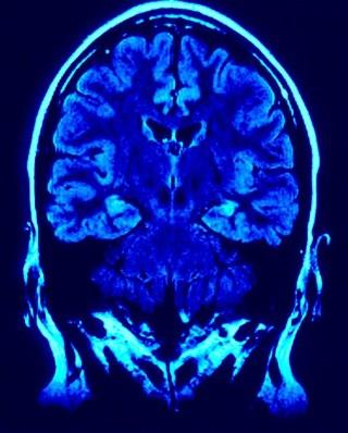 brain imaging