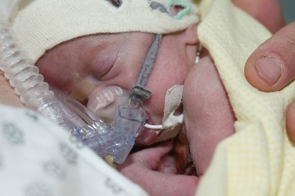 Longterm Effects Of Oxygen Therapy In Premature Infants Lovetoknow