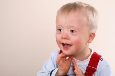 down syndrome