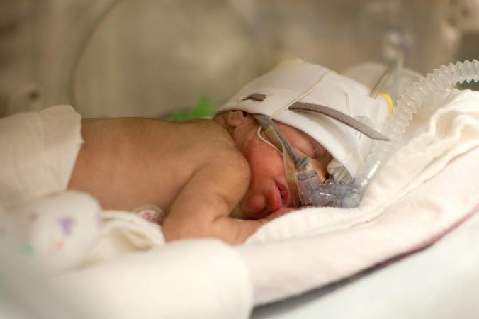 bebé prematuro con oxígeno