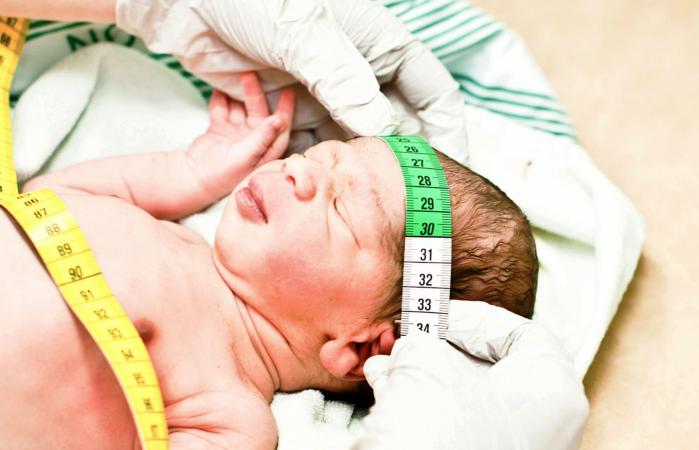 Medición de la cabeza de un bebé con cinta métrica