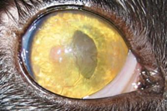 Eosinophilic keratitis