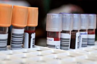 Blood samples to be typed