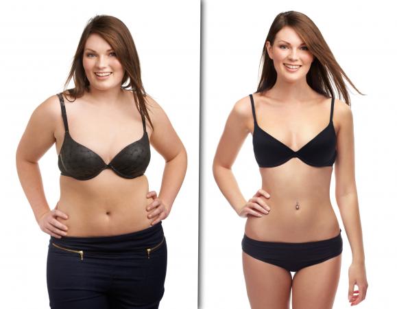 Before and after