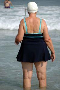Obese woman