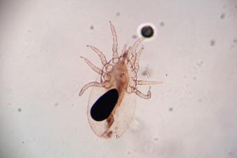 Microscope view of Sarcoptes scabiei