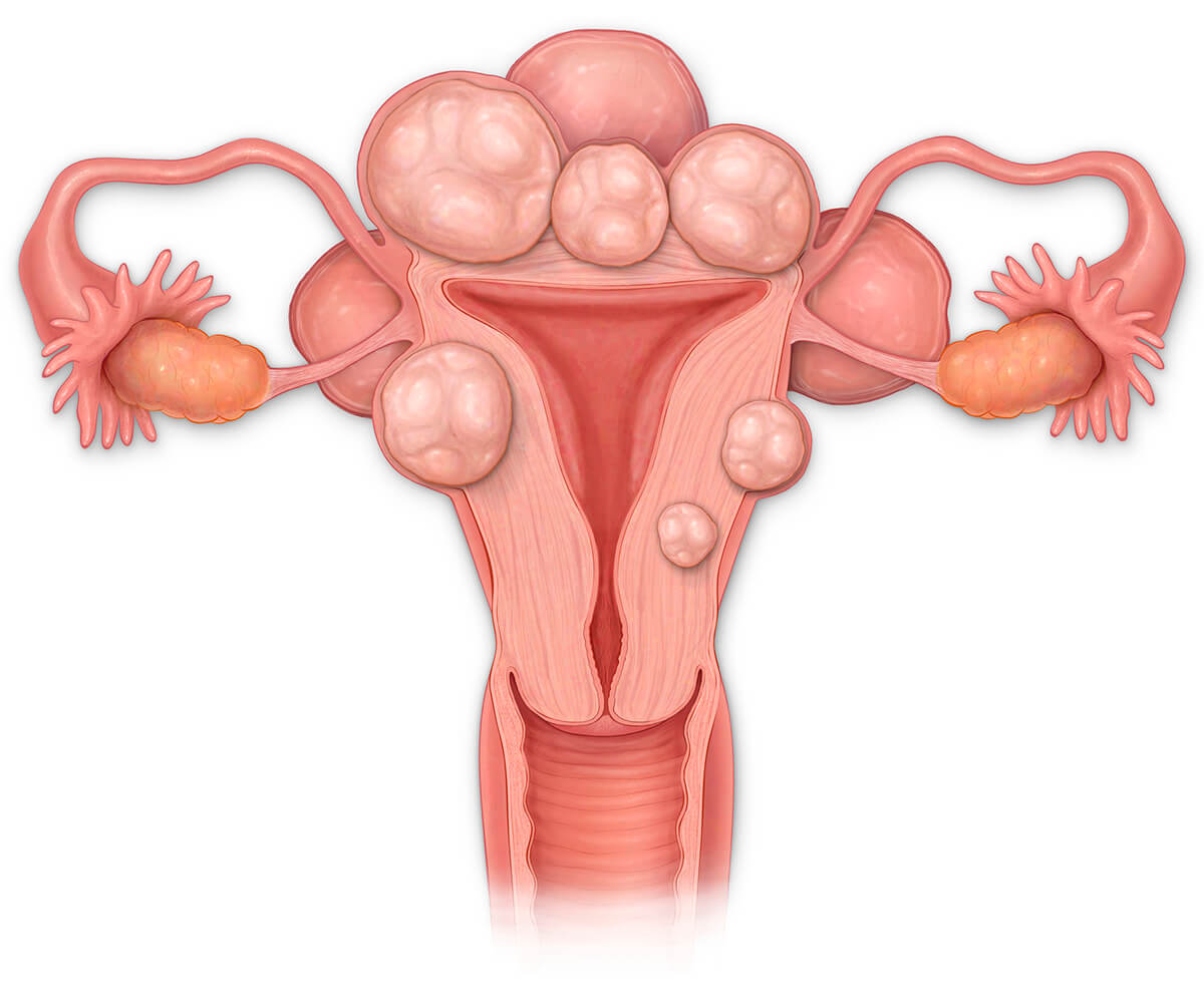 seccion-transversal-utero.jpg