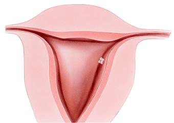 Utero de cuatro semanas