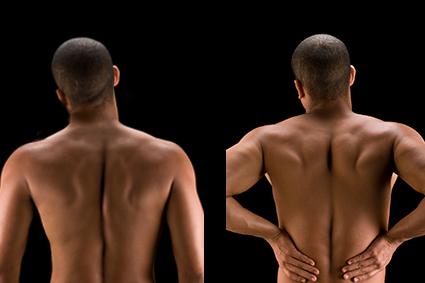Shoulder Blade Squeeze Exercise