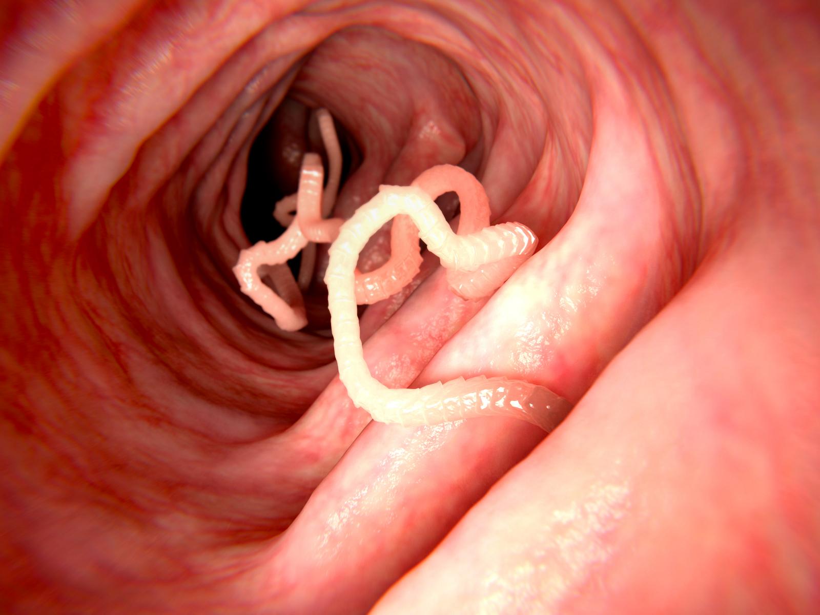 Tenias en el intestino