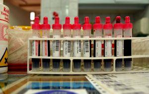 Blood test for IgA