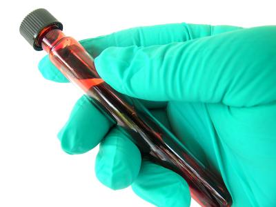 Blood Sample