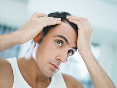 man-checking-hairline.jpg