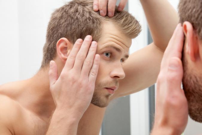 Man worried about hair loss