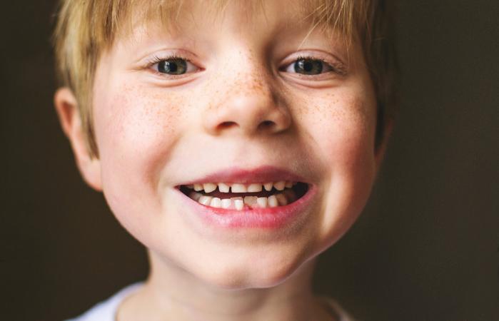 retrato de un niño con diente faltante