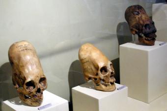 Paracas Skulls at Ica Museum