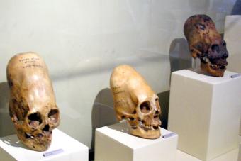 https://cf.ltkcdn.net/paranormal/images/slide/277280-850x567-paracas-skulls.jpg