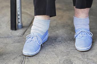 Senior Woman Swollen Ankles