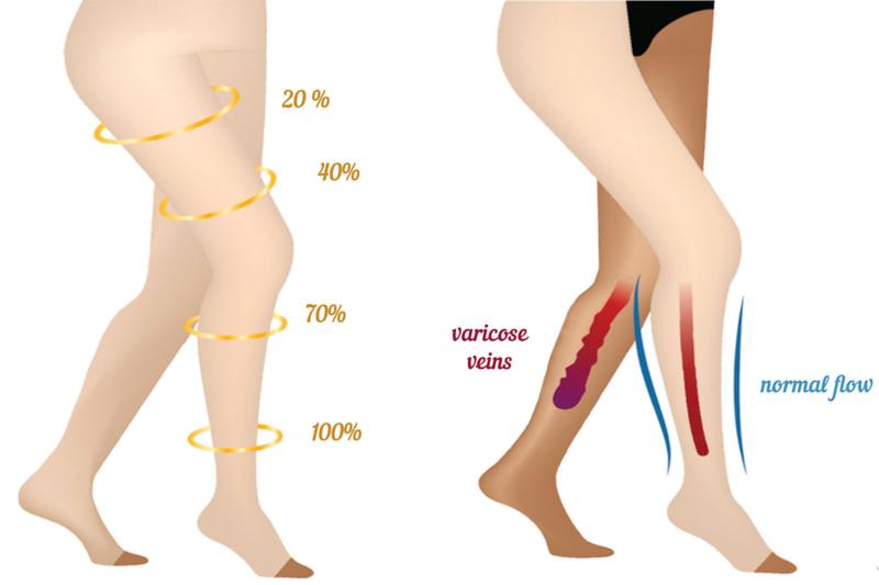 Support hose for varicose veins plus size Clearance