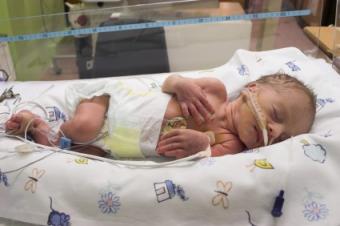 NICU incubator