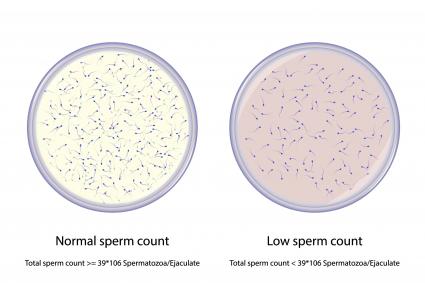 Comparison between normal and low sperm count