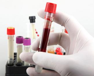 Hormone Tests