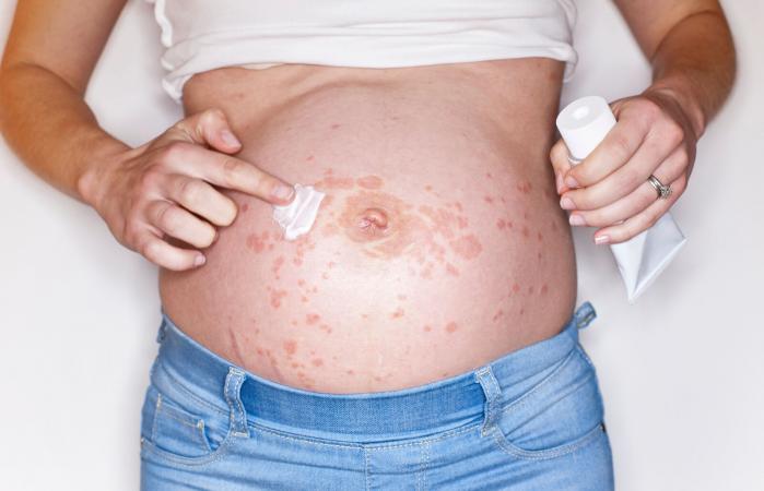 Pregnant woman applying cream on tummy
