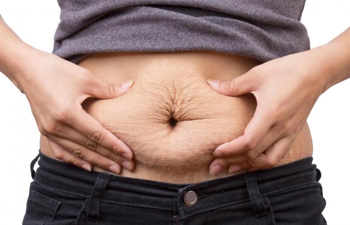 Woman pinching post-pregnancy skin