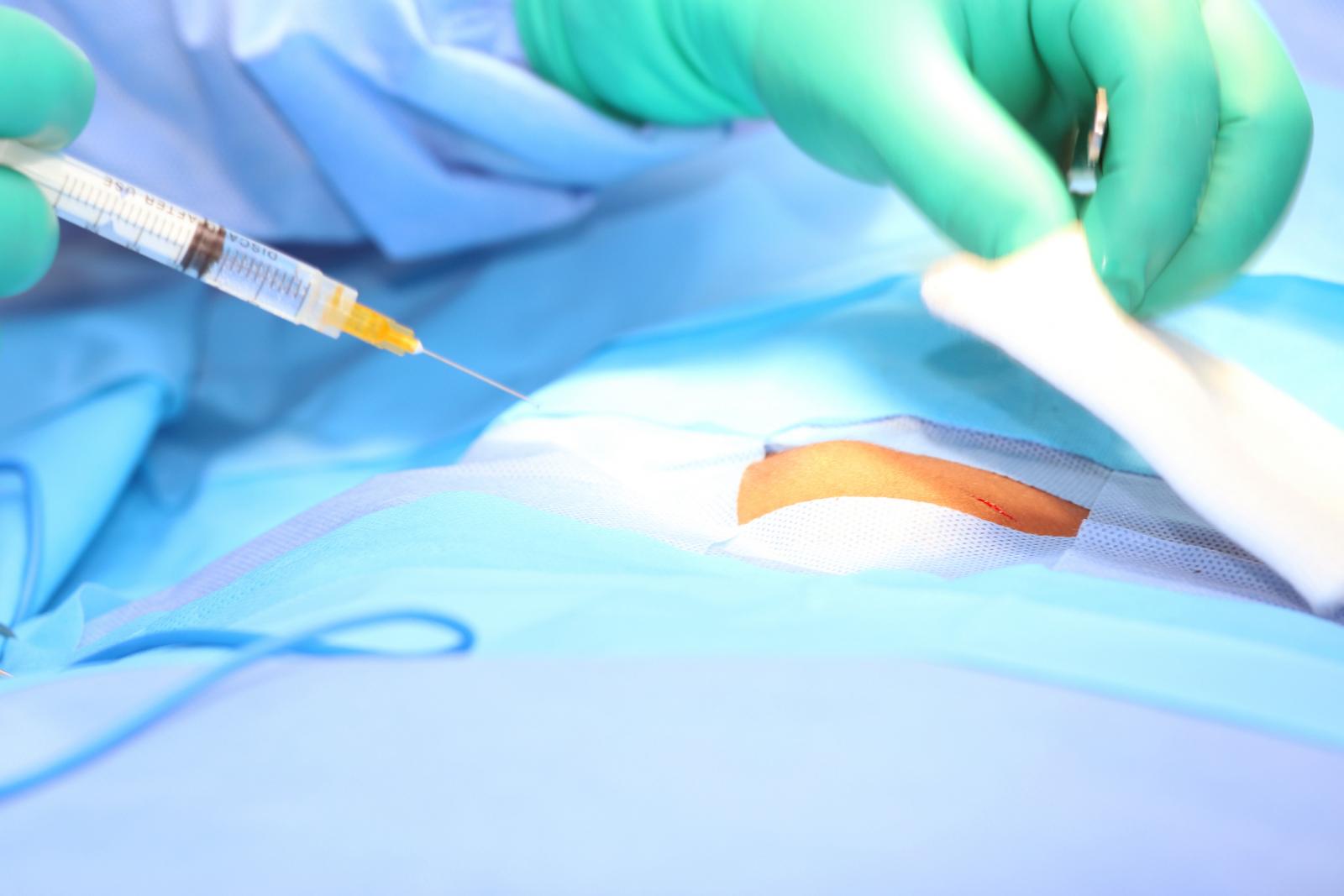 Doctor putting anesthesia in an open wound