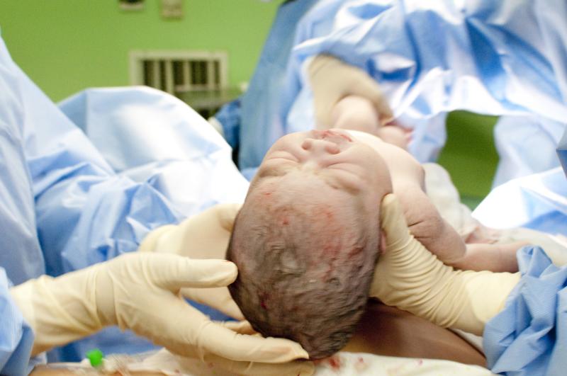 Episiotomy Procedure, Aftercare and Risks LoveToKnow Health & Wellness