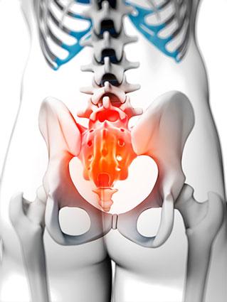 Painful sacrum