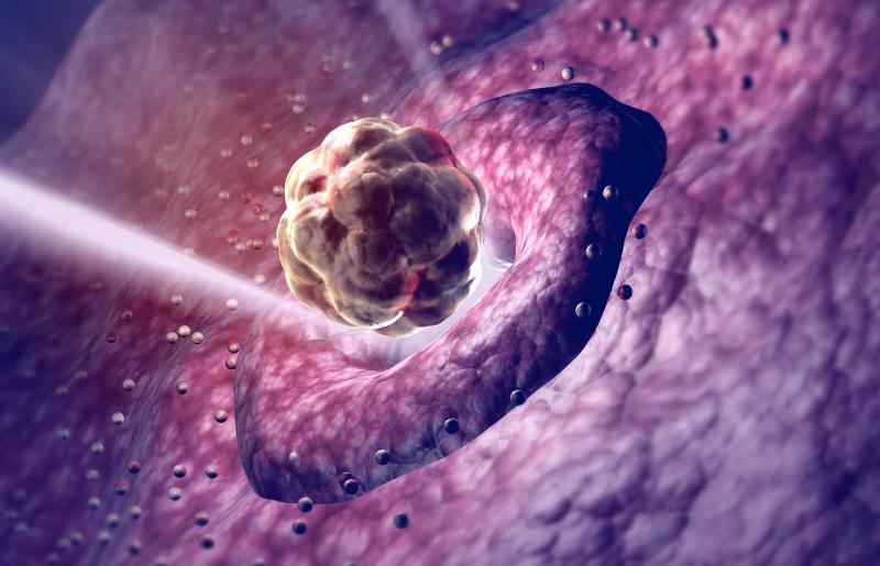 Can Early Ovulation Lead to Miscarriage? LoveToKnow Health & Wellness