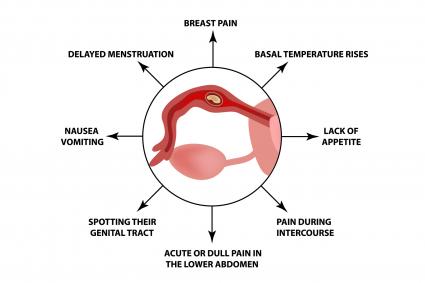 Symptoms of ectopic pregnancy