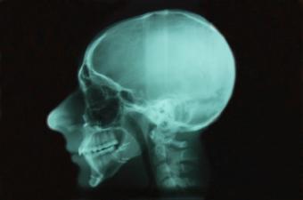 TMJ Treatment