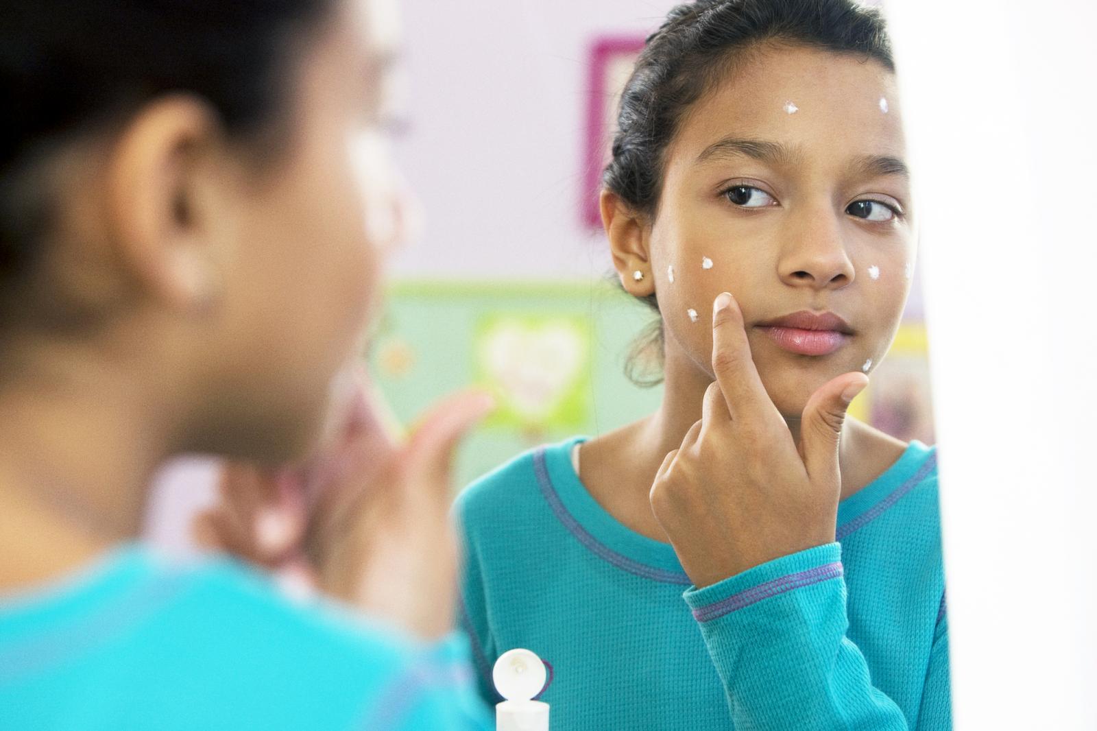 Girl putting on acne cream