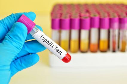 Syphilis test