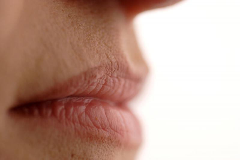 Cracked Corners of Lips LoveToKnow Health & Wellness