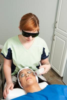 laser treatment for acne scars