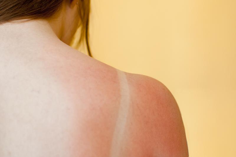 Red skin