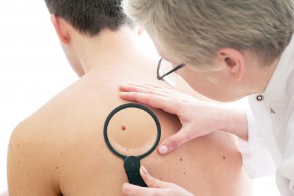 طبيب الأمراض الجلدية يفحص شامة لمريض ذكر