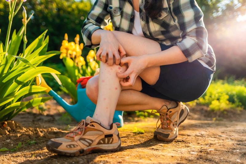 Person scratches her legs, which is itchy from a mosquito bite