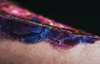 Tattoo healing